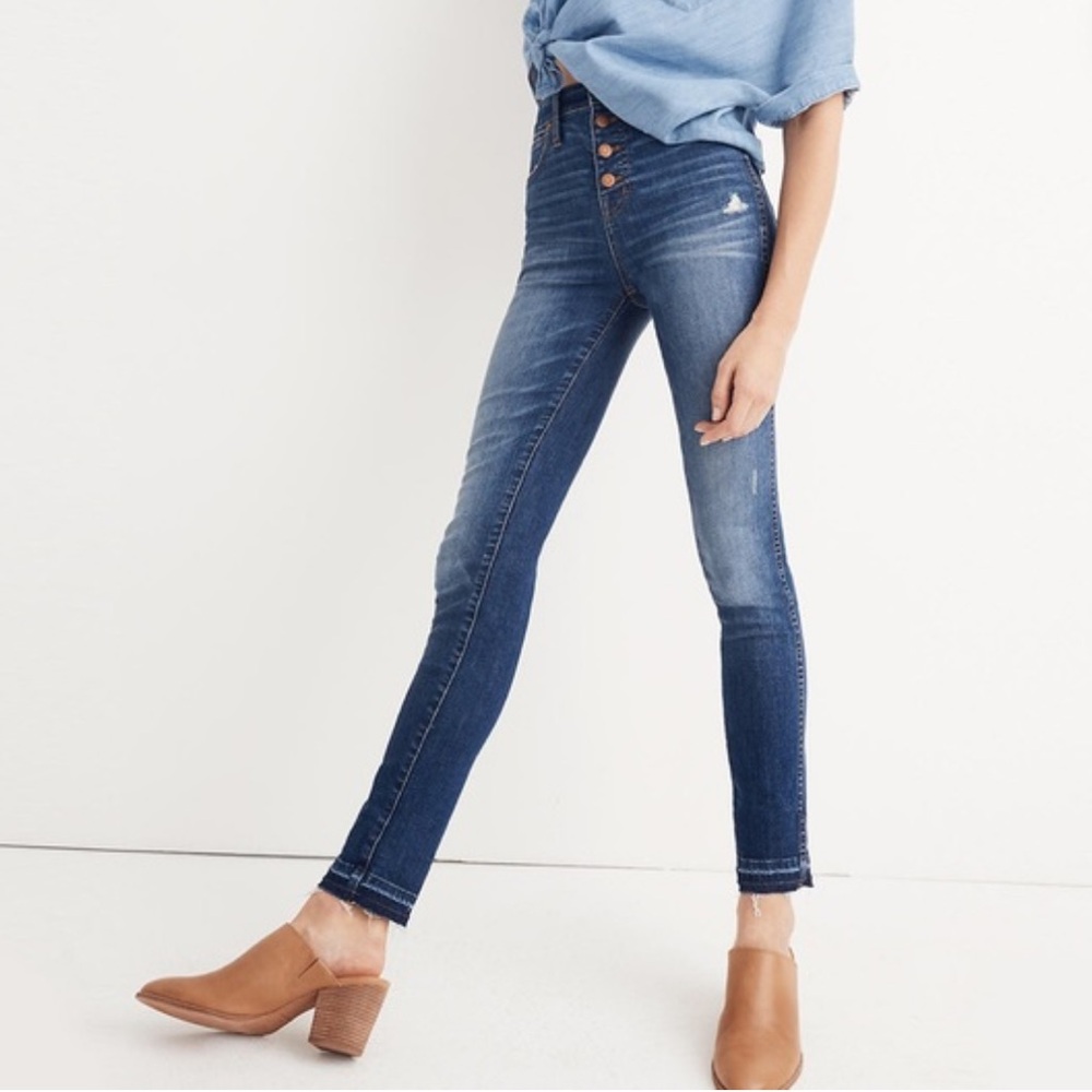 Madewell Button Through Skinny Jeans